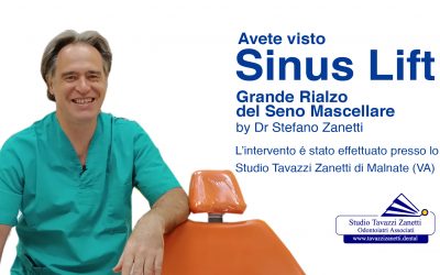 Sinus Lift – Grande Riazo Seno Mascellare